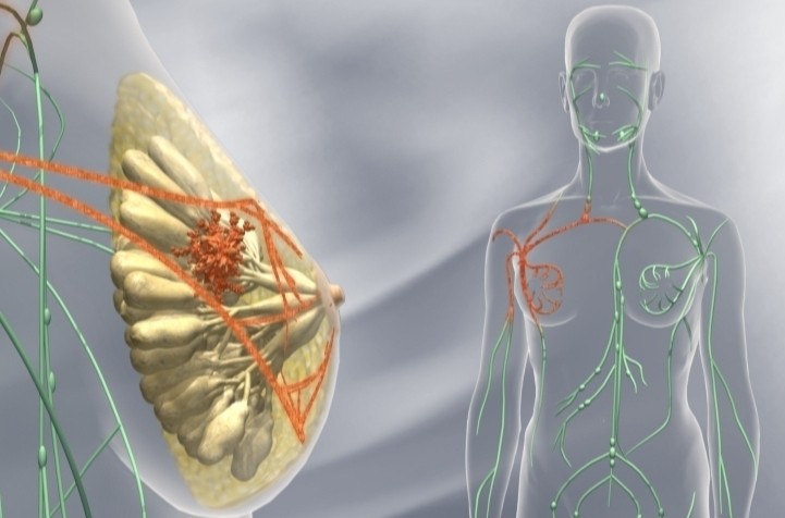 Traitement Naturel cancer Soin bio et Assurer une Guérison Définitive