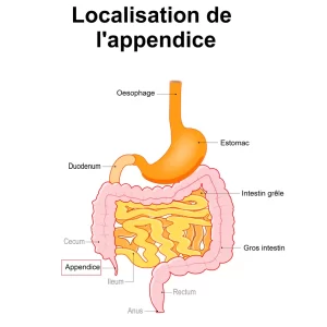 APS 010 : Remède Naturel Appendicite Antibiotique Sans Chirurgie