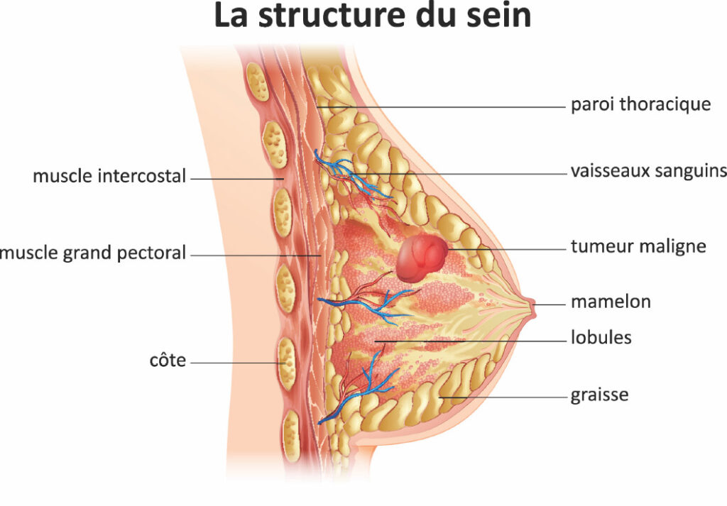 Comment Soigner le cancer du sein avec la médecine traditionnelle africaine : Découvrez nos remèdes naturels