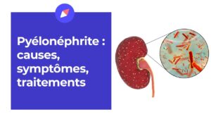pyelonephrite-schema- pyelonephrite APS 014 : Pyélonéphrite Traitement Naturel, Néphrite Causes et Symptômes