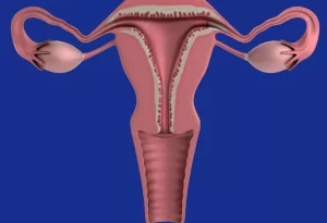schéma-uterus-Remède 020 : Comment Assécher Fibrome Naturellement sans Chirurgie Vita-Vita