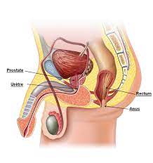 Comment Eviter la Prostate Remède naturel Les-différentes-techniques-de-prostatectomie