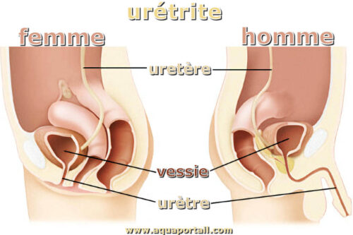 uretrite APS 03 : Urétrite Traitement Naturel Infections Urinaires