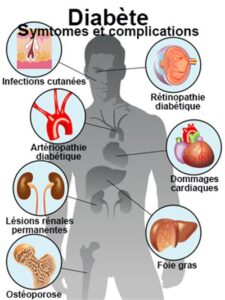 Syringe and medical drugs for diabetes, metabolic disease treatment APS 01 : Traitement Naturel du Diabète