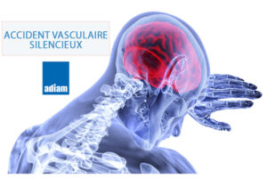 Accident-vasculaire-cerabral COMMENT RETROUVER CES MEMBRES PARALYSÉS SUITE À UN AVC, Recette et solution naturelle 