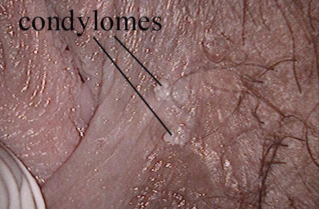 Comment Traiter les Maladies Courantes? - Remèdes Naturels de la Médecine Africaine pour Traiter les Maladies Courantes