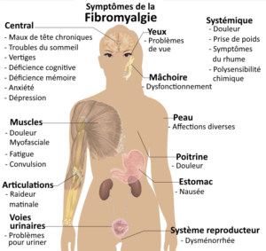 Comment Libérez-vous de la Fibromyalgie avec nos Traitements Naturels?