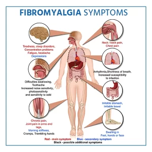 Comment soigner Fibromyalgie Traitement Naturel en 8 Semaines?