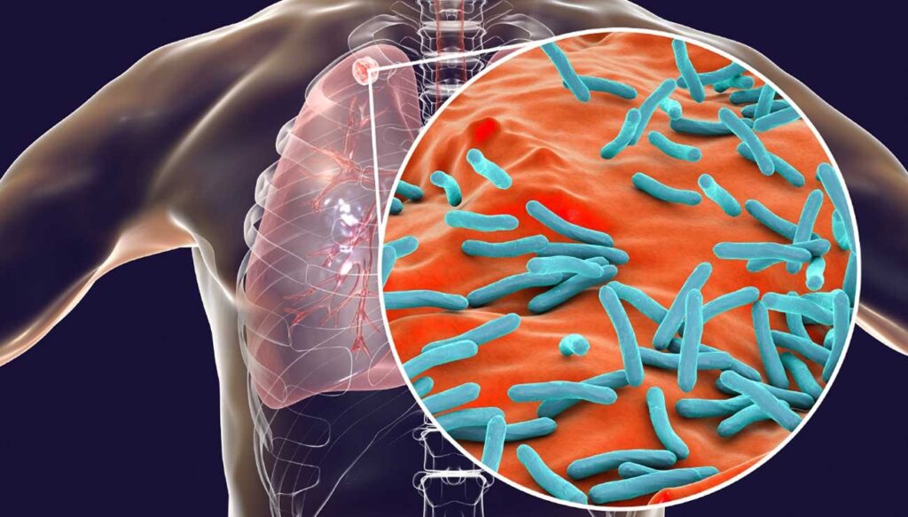 Soin Naturel pour Renforcer le systhème Immunitaire