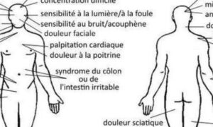 Comment Guérir la Fibromyalgie en 8 Semaines Soin et Traitement Naturel? 