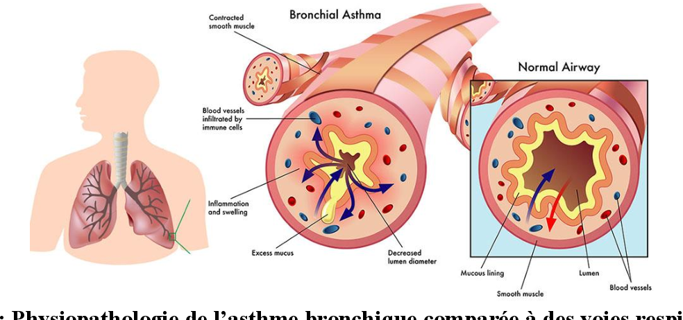 Comment Libérer Vos Poumons des Maladies Respiratoires avec Afrique Pharma Santé