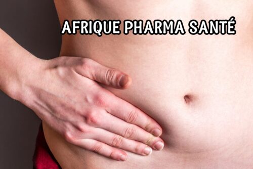 Hernie Crurale : Une Guérison Naturelle Assurée par Afrique Pharma Santé