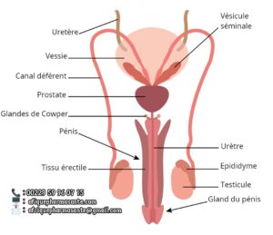 Remède 146 : Prise en charge et Remède Priapisme Traitement Naturel pour Érection Permanente