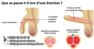 Thérapie Prise en charge Priapisme Traitement Naturel