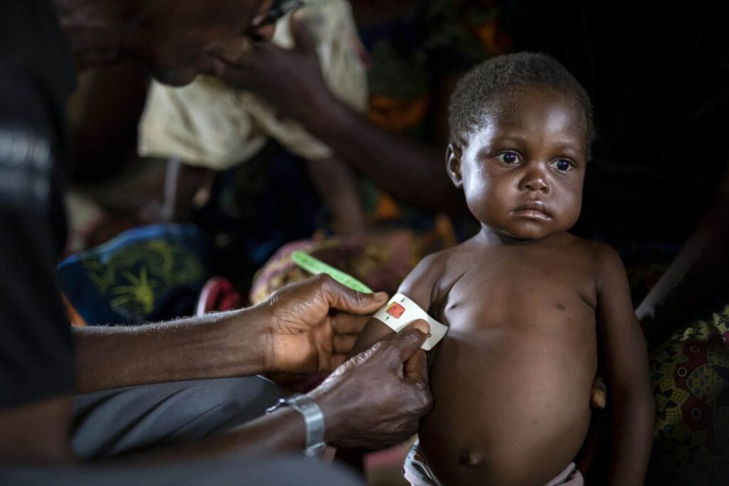 Quel sont les moyens pour lutter contre la malnutrition?