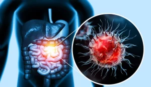 Cancer Remède bio, découvrez la solution naturelle pour guérir le cancer ici.