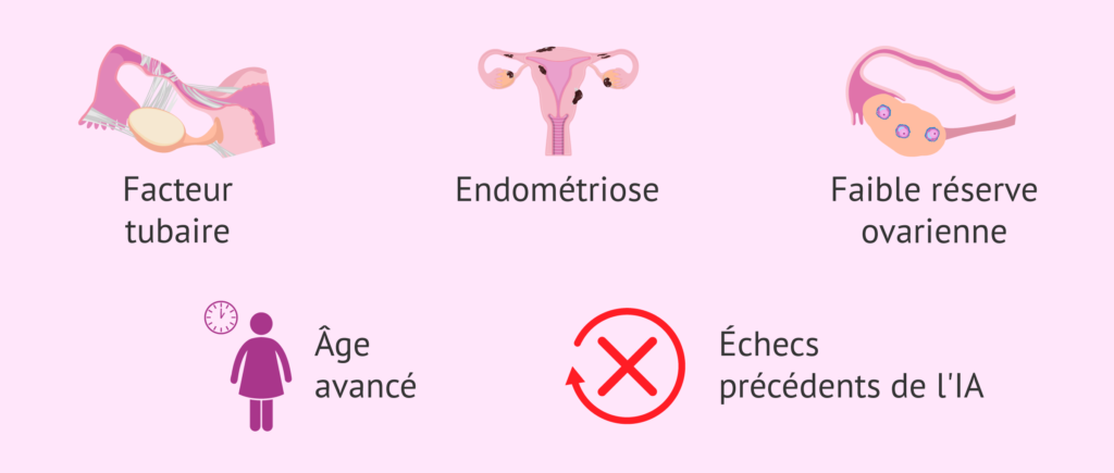 Comment soigner l'infertilité et tomber enceinte Traitement bio?