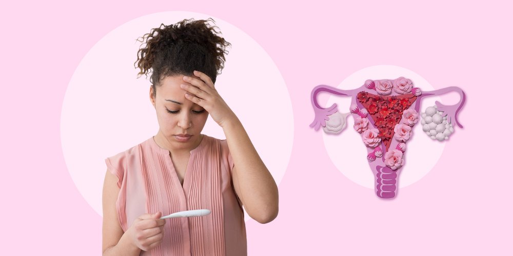 Comment traiter l'infertilité féminine définitivement?