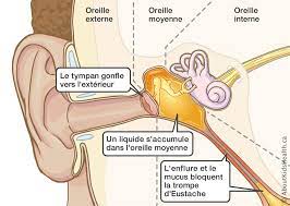 RECETTE CONTRE LES MAUX D'OREILLES