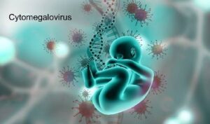 Comment Traiter l'Infection à Cytomégalovirus Naturellement au USA, au canada, et en Afrique avec Afrique Pharma Santé : Guérison Définitive en 8 Semaines