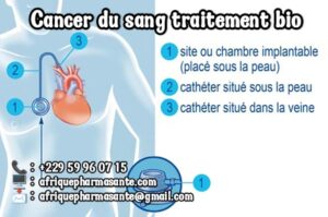 Voilà le Traitement de la leucémie remède bio pour soigner le Cancer du Sang