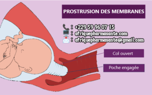 Comment fermer le col pendant la grossesse ?