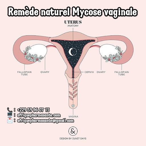 Traitez la Mycose Vaginale Naturellement : Guérison Définitive en 8 Semaines avec Afrique Pharma Santé