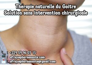 Traitement Naturel du Goitre : Une Solution Efficace et Définitive Disponible sur Afrique Pharma Santé