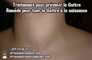 Traitement Naturel du Goitre : Une Solution Efficace et Définitive Disponible sur Afrique Pharma Santé