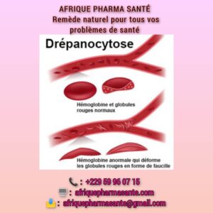 Remède 184 : Thérapie Naturel pour guérir la Drépanocytose Traitement naturel et définitif