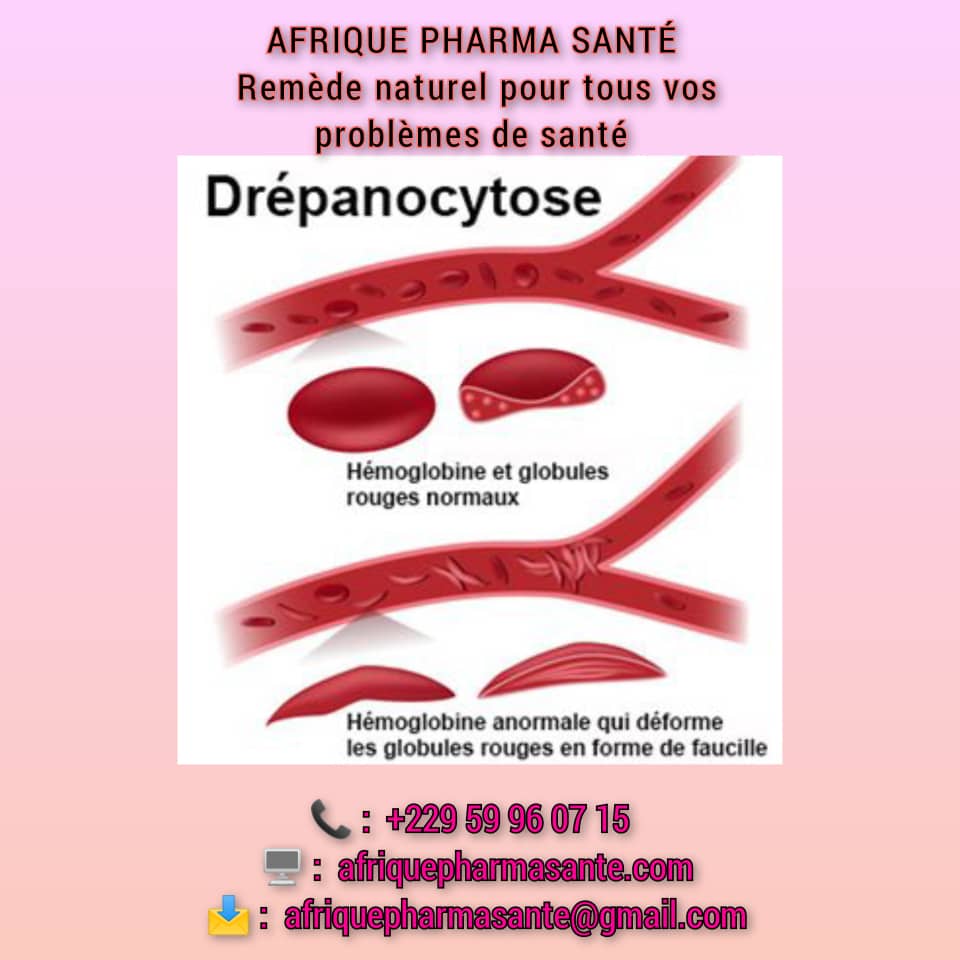 Traitement Naturel pour la Drépanocytose Disponible sur Afrique Pharma Santé