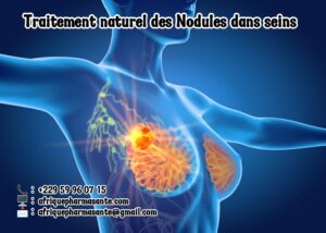 Comment soigner les Nodules Kystiques de la Thyroïde? Remèdes Naturels de grand-mère