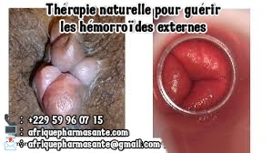 TRAITEMENT NATUREL DES HÉMORROÏDES SOIN BIO