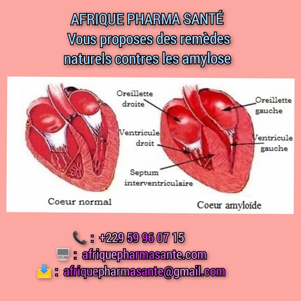 Traitement Naturel de l’Amylose