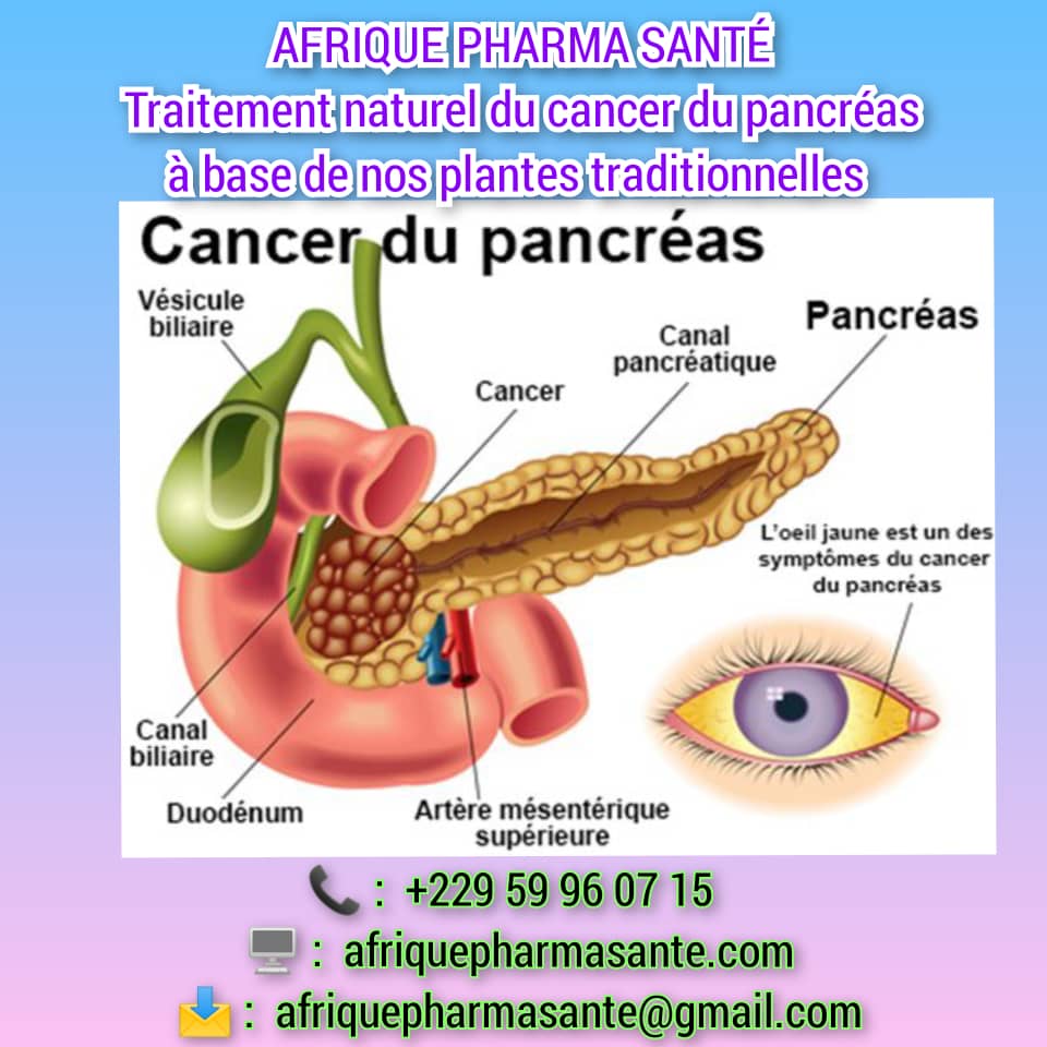 Comprendre le Cancer du Pancréas et Trouver un Traitement Naturel Efficace