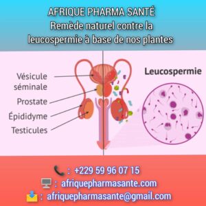 Traitement Naturel pour guérir la Leucospermie et l’Arthenospermie définitivement Zoome sur la Leucospermie et l’Arthénospermie