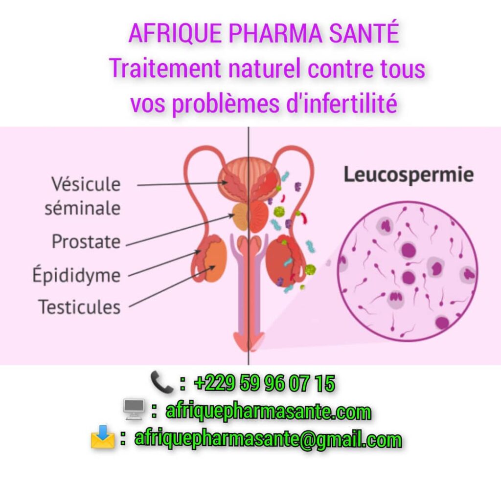 Traitement naturel de l’infertilité : Causes, Symptômes et Traitement Naturel Disponibles sur Afrique Pharma Santé