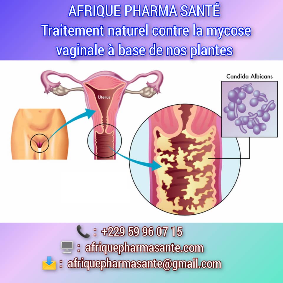 Soin Bio Mycose Vaginale : Causes, Symptômes et Traitements Naturels avec AFRIQUE PHARMA SANTÉ, Remède bio naturel Mycose Vaginale