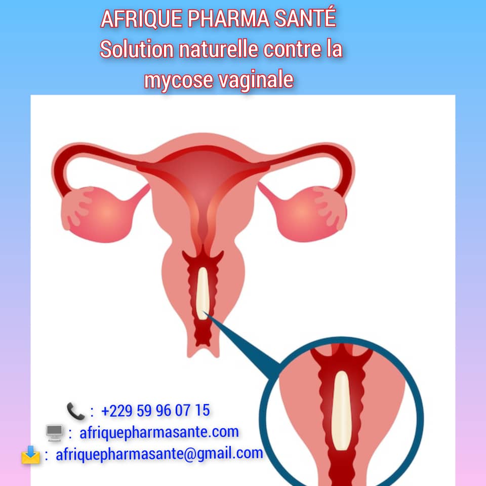 Thérapie Naturelle de la Mycose Vaginale TradiCura-Mycose Vaginale Traitement naturel