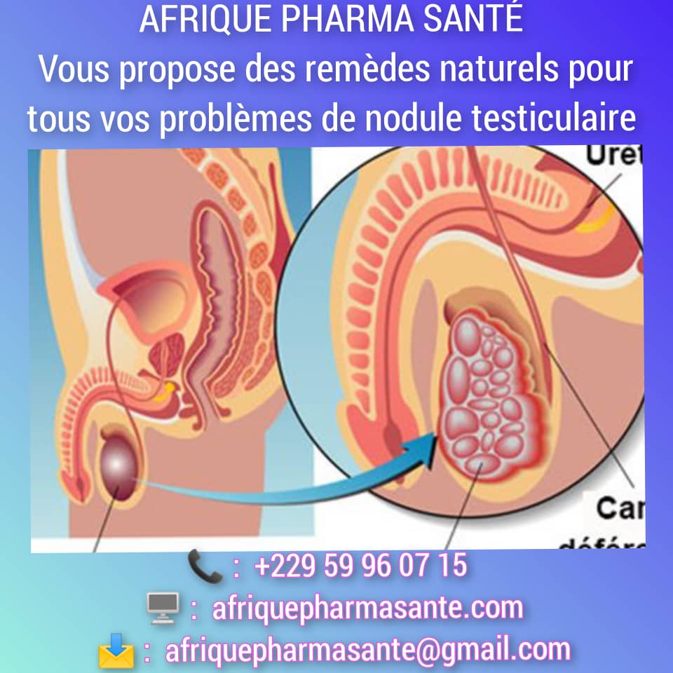 Comment finir avec les Troubles de l'érection : Comprendre les Causes, Symptômes et Solutions Naturelles Disponibles chez Afrique Pharma Santé