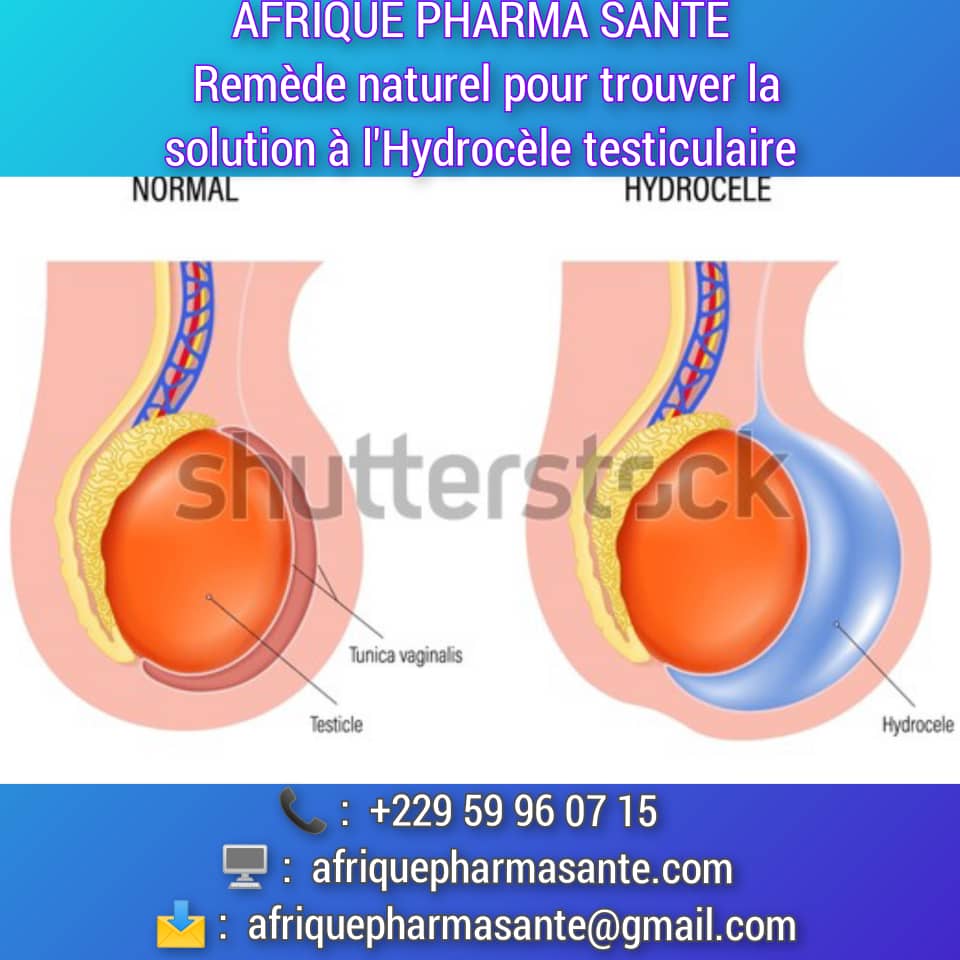 Comment guérir l'Hydrocèle testiculaire Naturellement: Causes, Symptômes et Traitement Naturel Disponible sur AFRIQUE PHARMA SANTÉ