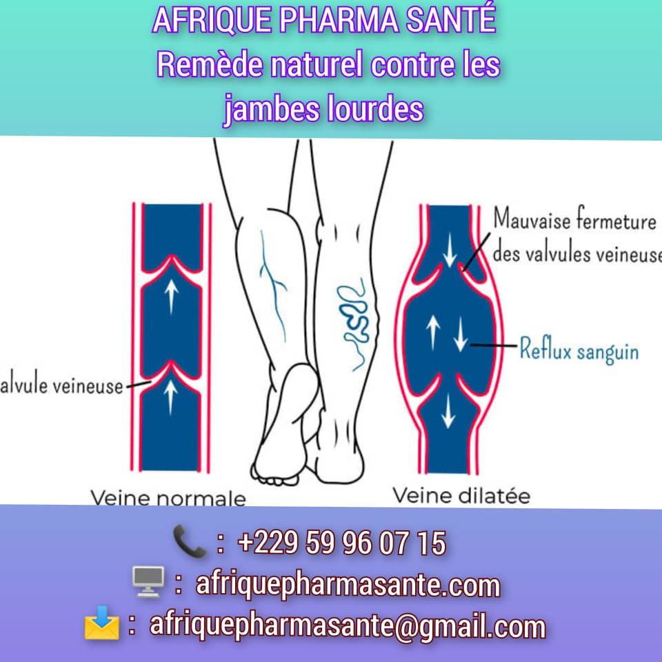 Meilleur remède pour Soulager et Traiter les Jambes Lourdes : Une Solution Naturelle avec Afrique Pharma Santé