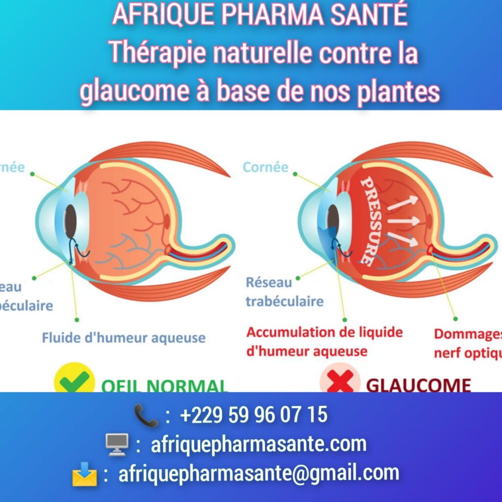 Voilà le meilleur Traitement Naturel du Glaucome : Solutions Bio Disponibles chez AFRIQUE PHARMA SANTÉ