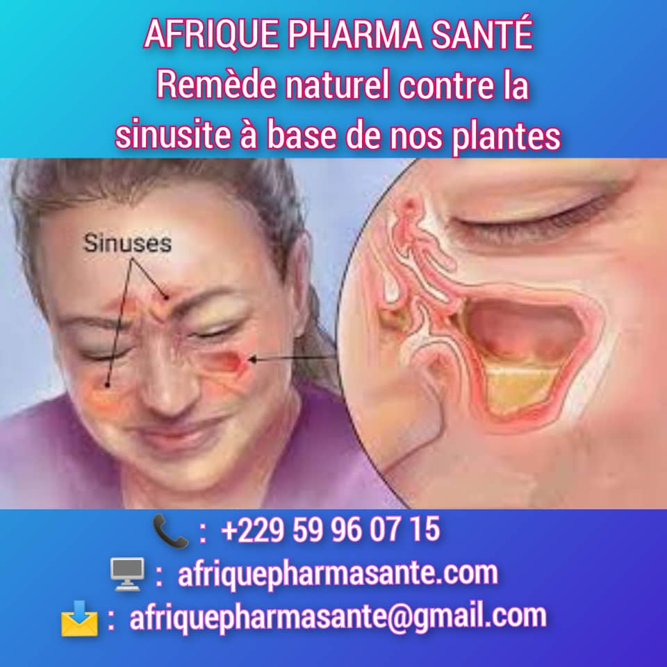 Voilà le remède de Soulagement Naturel de la Sinusite : Causes, Symptômes et Traitement Bio chez Afrique Pharma Santé