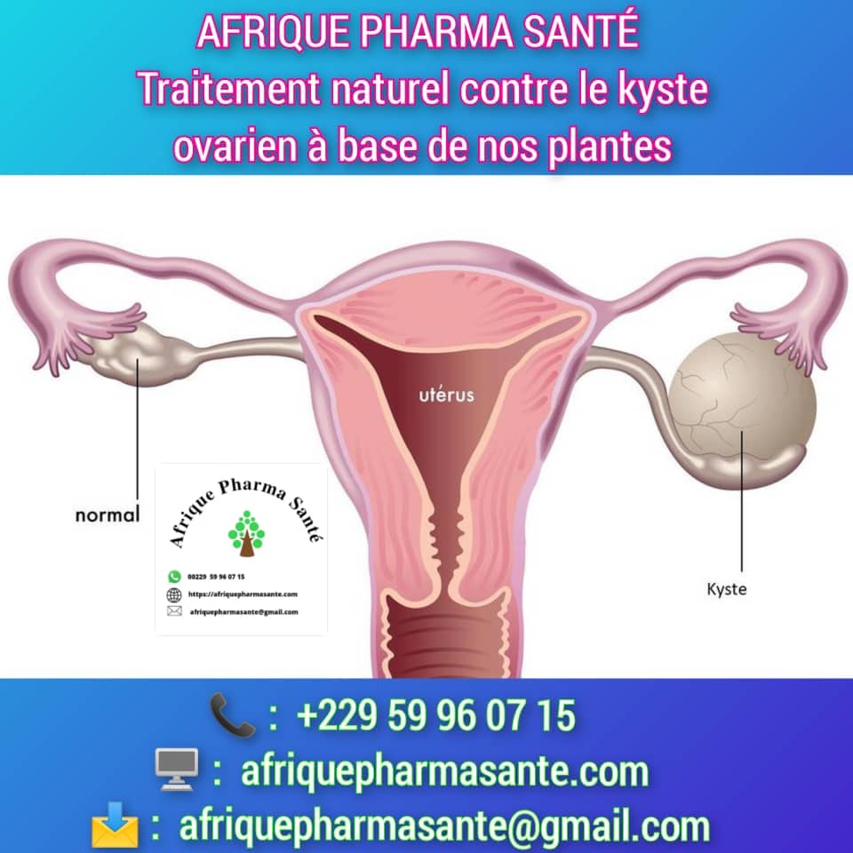 Traitement Naturel et Efficace Contre les Kystes Ovariens – Guérison Complète avec AFRIQUE PHARMA SANTÉ