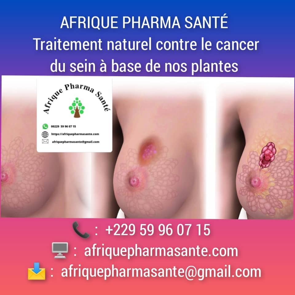 Voilà le Traitement Naturel contre le Cancer du Sein – Afrique Pharma Santé