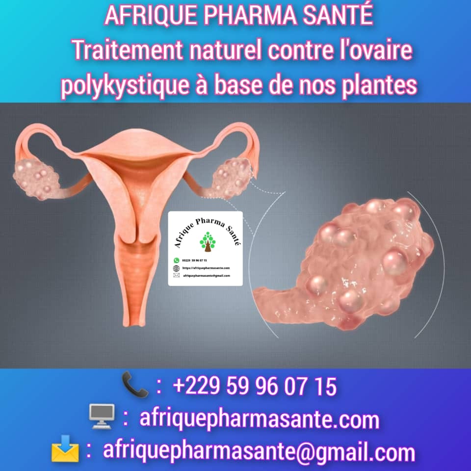 Traitement Naturel des Ovaires Polykystiques : Une Solution Sans Chirurgie sur Afrique Pharma Santé