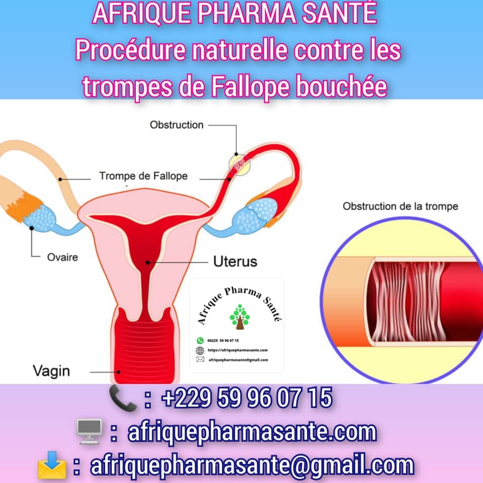 Meilleur Traitement Naturel pour les Trompes de Fallope Bouchées : Guérison Assurée sur AFRIQUE PHARMA SANTE