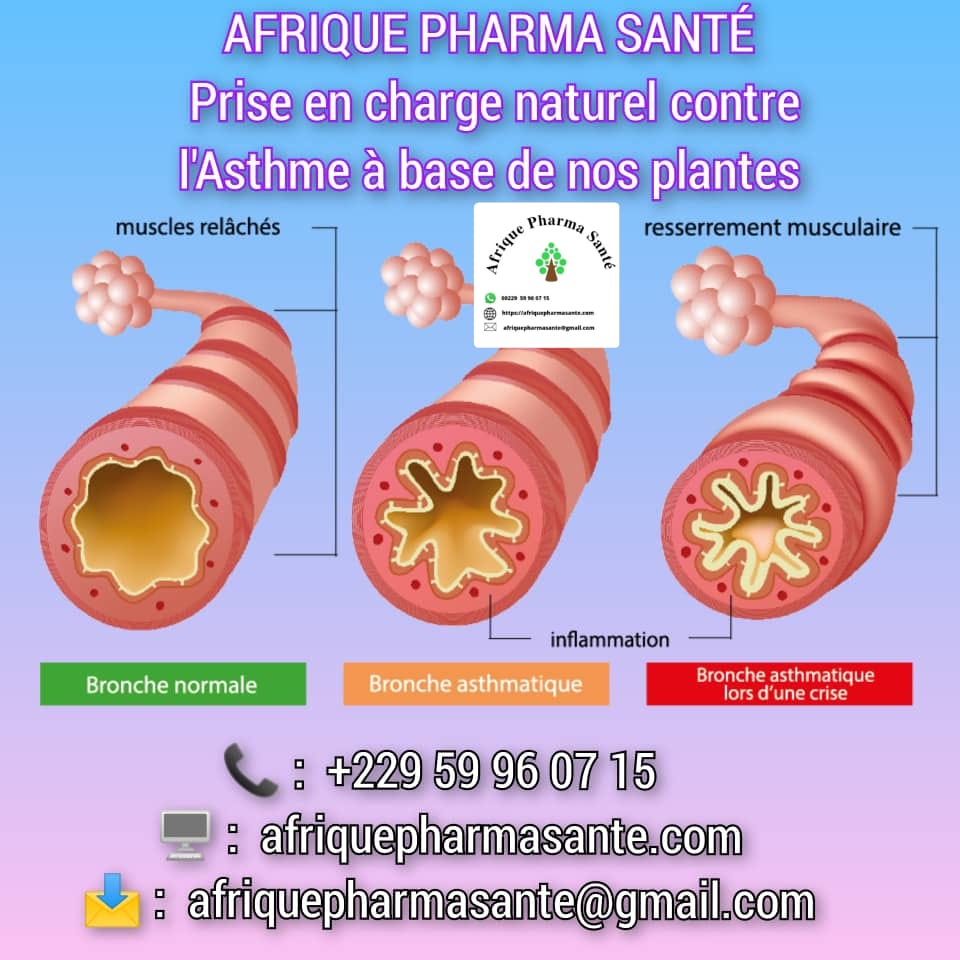 Meilleur traitement Naturel Contre l'Asthme - Découvrez les Solutions de Soin Bio chez Afrique Pharma Santé