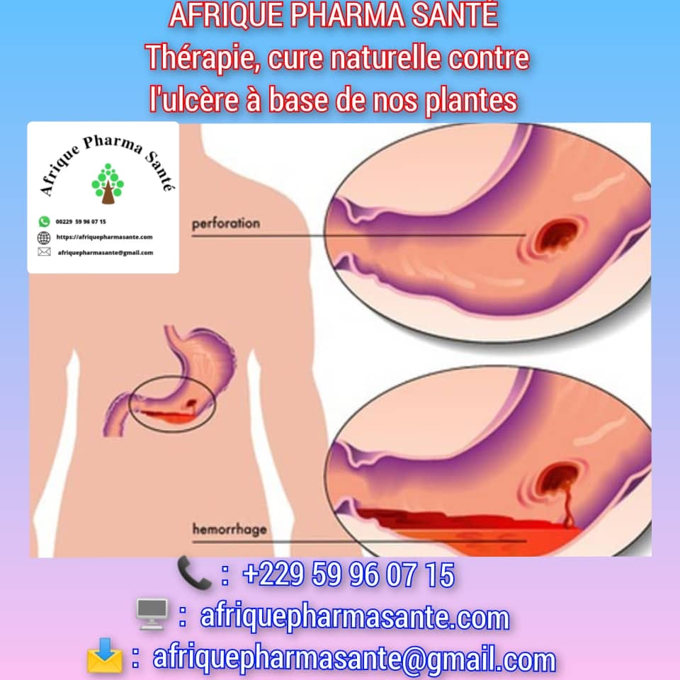 Comment soigner les Ulcères naturellement : Causes, Symptômes et Traitements Naturels Disponibles chez Afrique Pharma Santé